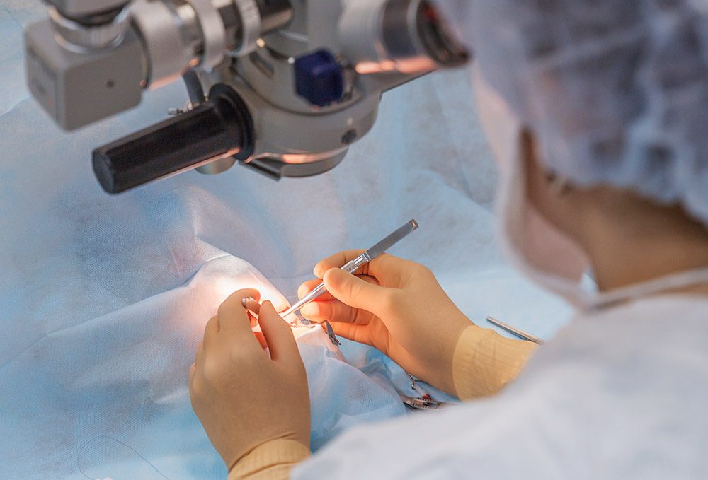 Cataract Procedure