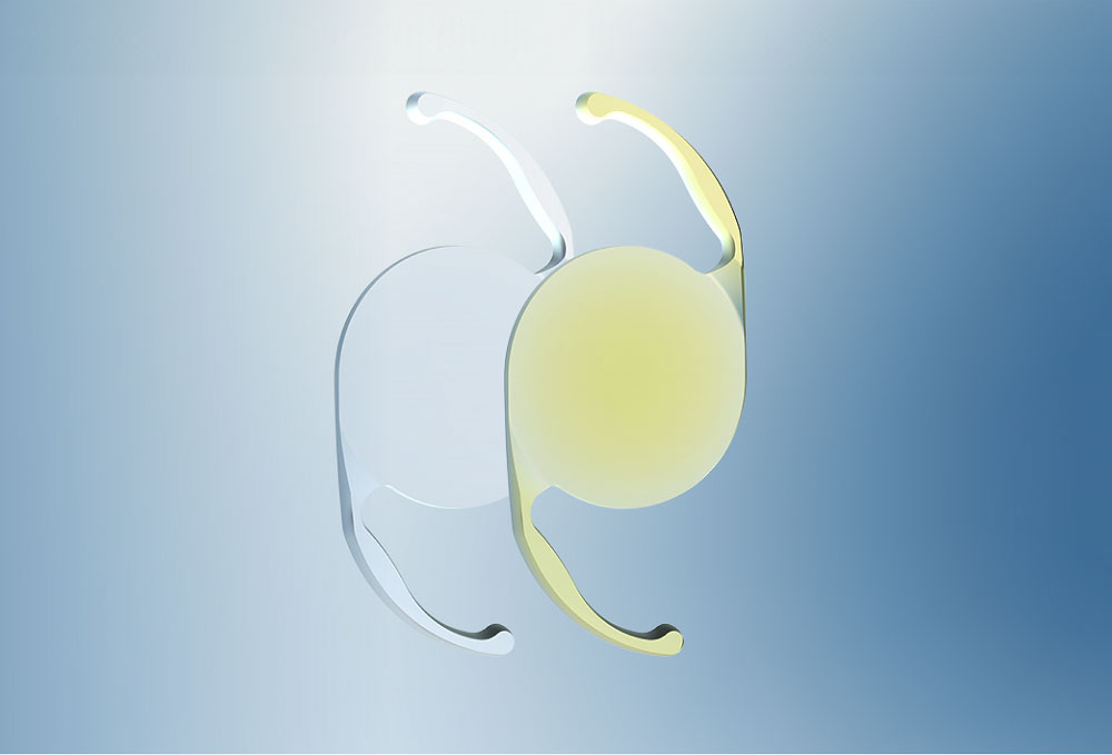 Clarion Monofocal IOL
